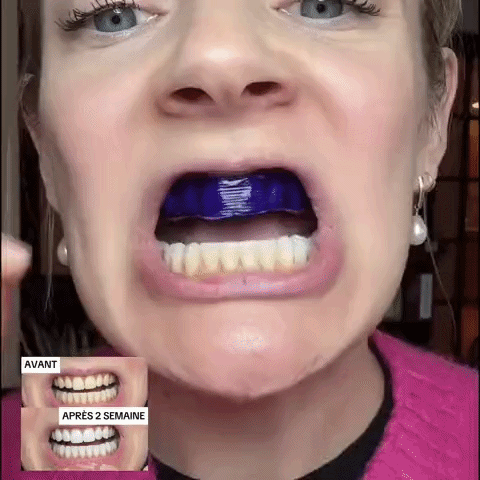 NovaBlanc - Bandes Blanchissantes Correction Chromatique™